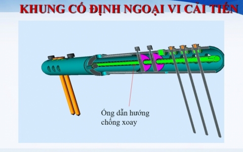 Sáng kiến nhỏ, lợi ích lớn