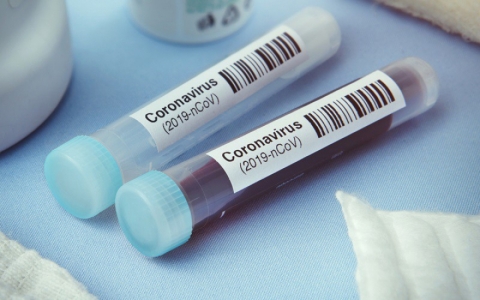 Séc dự kiến kéo dài tình trạng khẩn cấp Covid-19 thêm 30 ngày